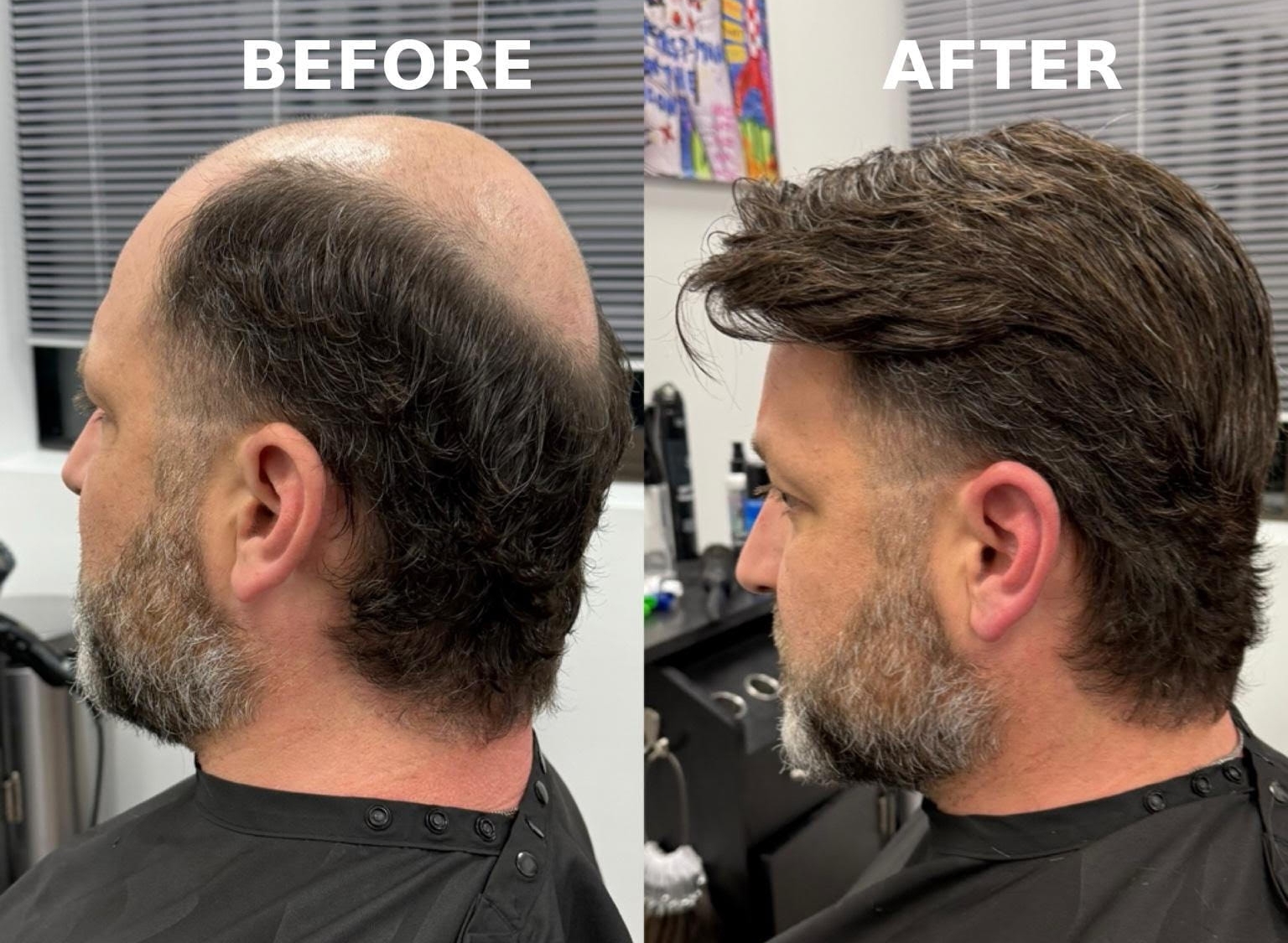 Before and after comparison
